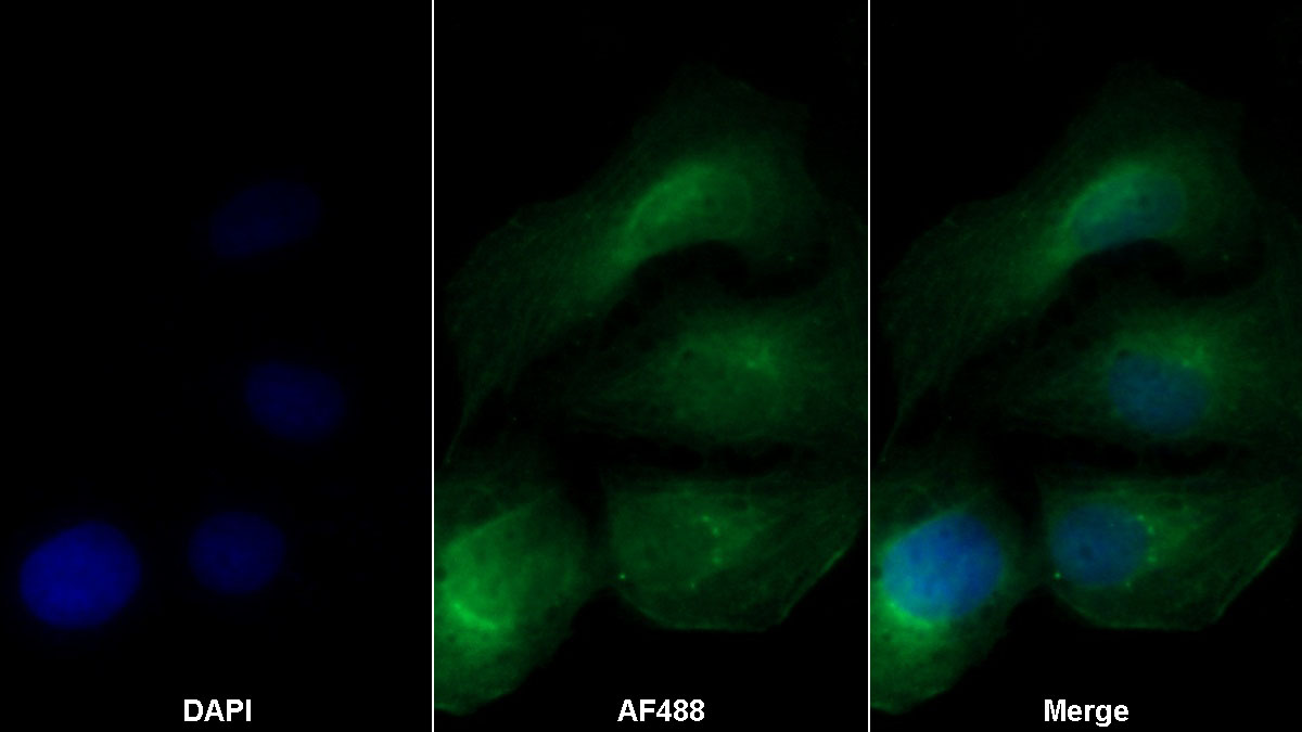 Monoclonal Antibody to Transforming Growth Factor Beta 1 (TGFb1)