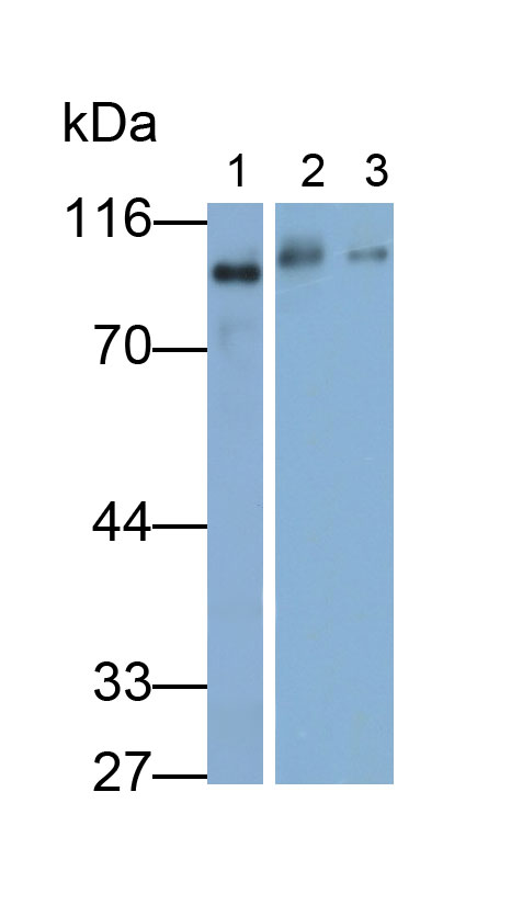Monoclonal Antibody to Complement 1 Inhibitor (C1INH)