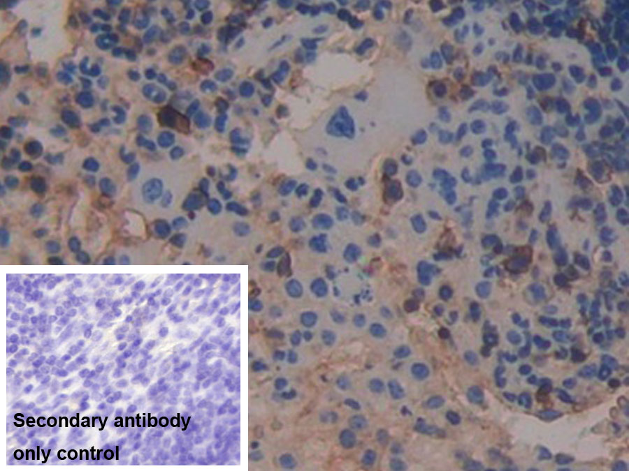 Monoclonal Antibody to Beta-2-Microglobulin (b2M)