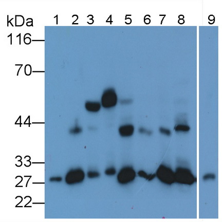 Monoclonal Antibody to Cathepsin K (CTSK)