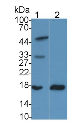 Monoclonal Antibody to Retinol Binding Protein 2, Cellular (RBP2)