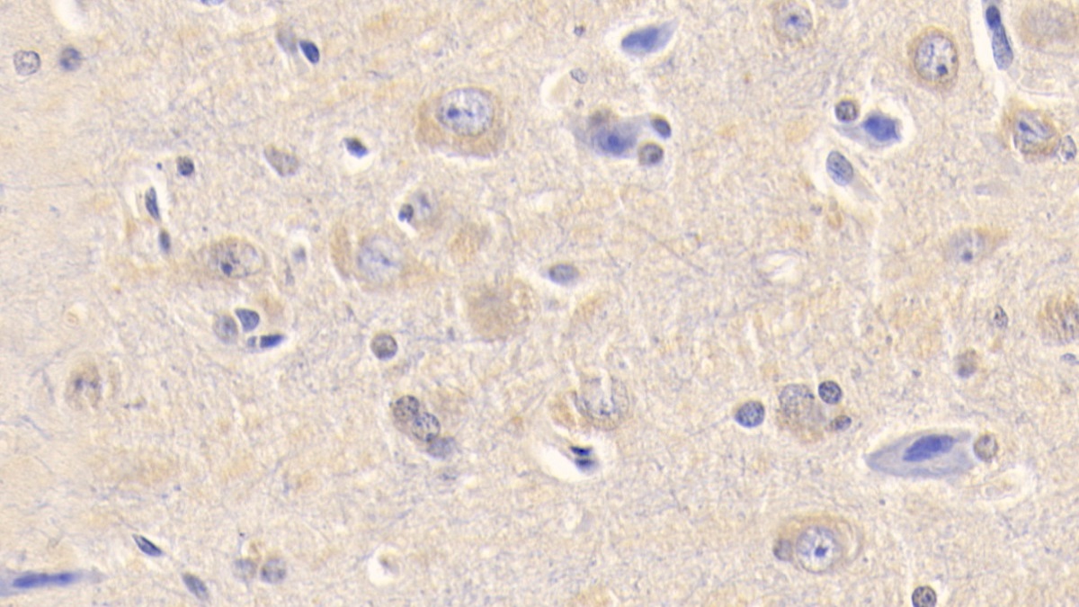 Monoclonal Antibody to Complement Component 3a (C3a)