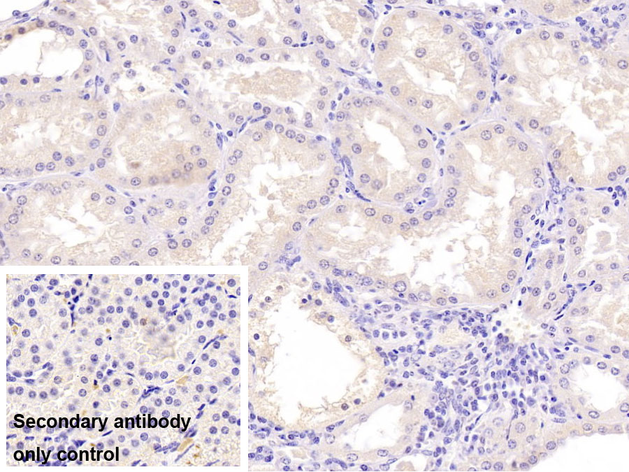 Monoclonal Antibody to Sex Hormone Binding Globulin (SHBG)