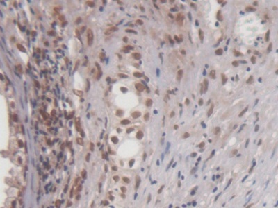 Monoclonal Antibody to Early Growth Response Protein 1 (EGR1)