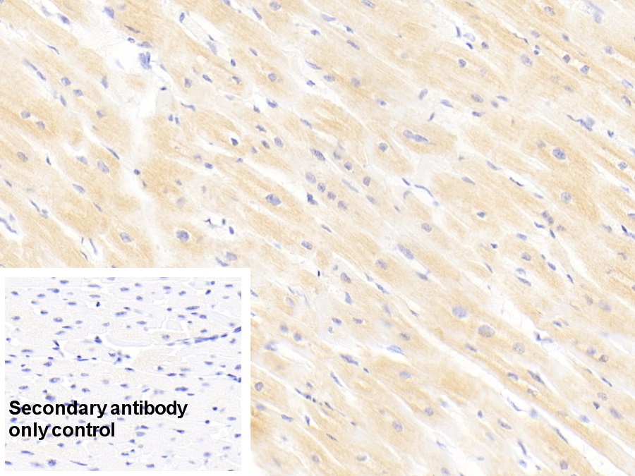 Monoclonal Antibody to Cardiac Troponin I (cTnI)