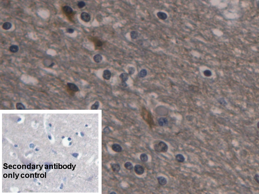 Monoclonal Antibody to Enolase, Neuron Specific (NSE)