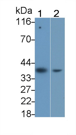 Monoclonal Antibody to Interleukin 1 Beta (IL1b)