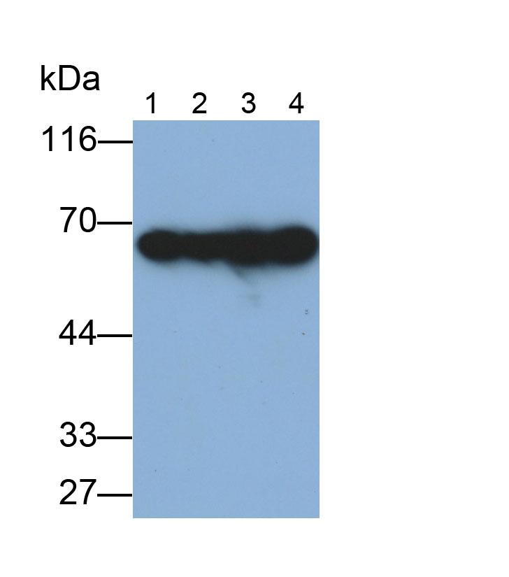 Monoclonal Antibody to Pyruvate kinase isozymes M2 (PKM2)