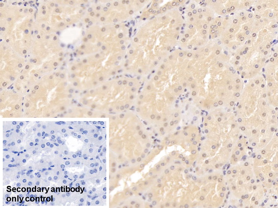 Monoclonal Antibody to Adiponectin (ADPN)