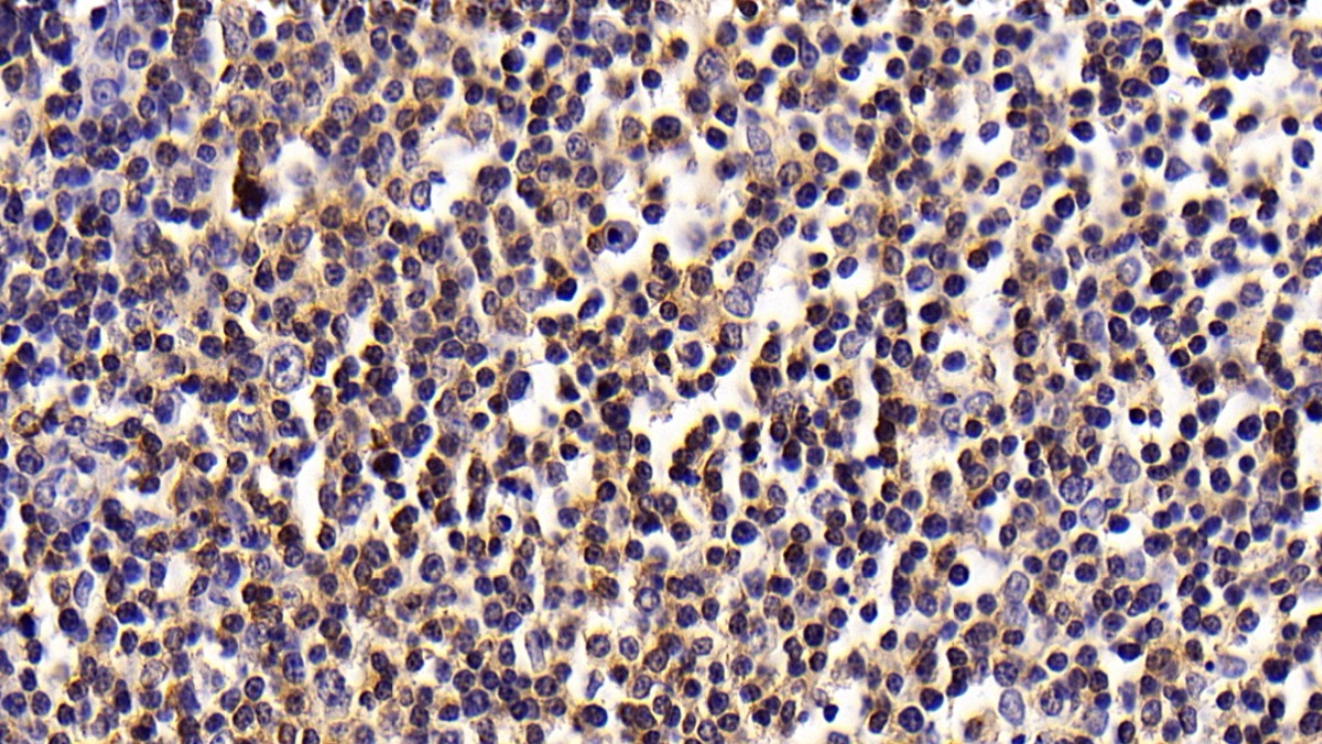 Monoclonal Antibody to Cluster Of Differentiation 14 (CD14)