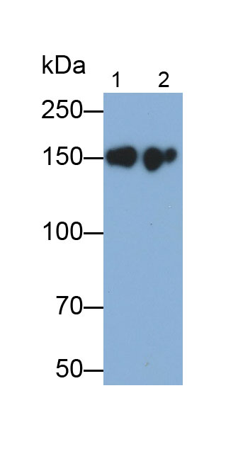 Monoclonal Antibody to Epidermal Growth Factor Receptor (EGFR)