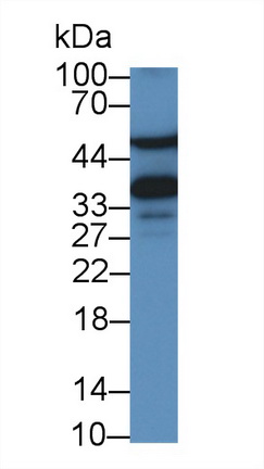Monoclonal Antibody to Alpha-1-Acid Glycoprotein (a1AGP)