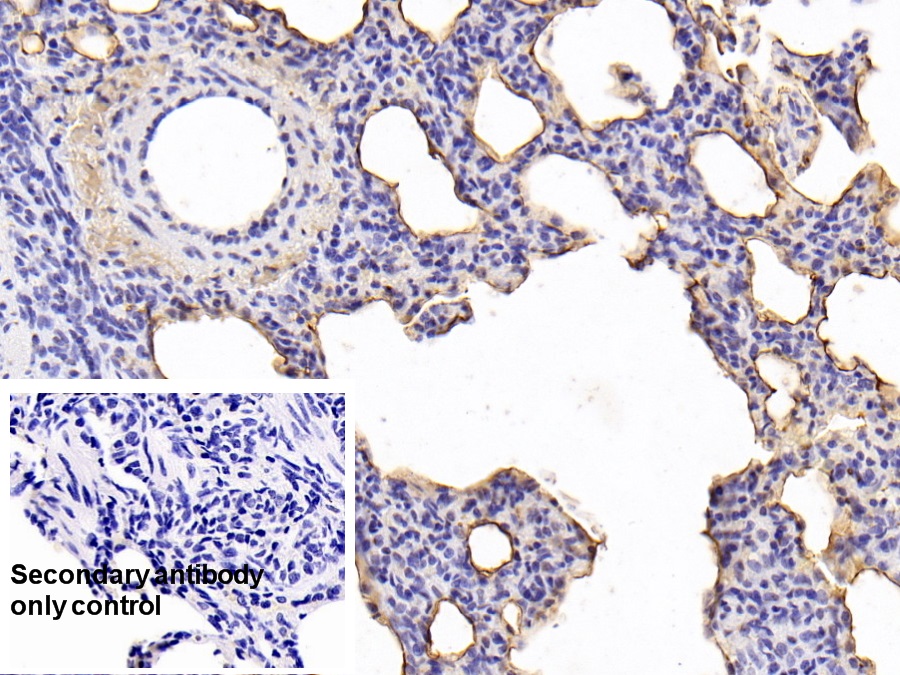 Monoclonal Antibody to Pulmonary Surfactant Associated Protein A1 (SFTPA1)