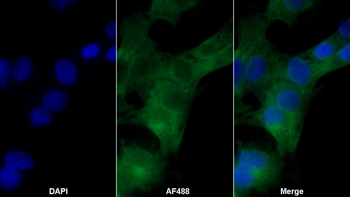 Monoclonal Antibody to Apoptotic Peptidase Activating Factor 1 (APAF1)