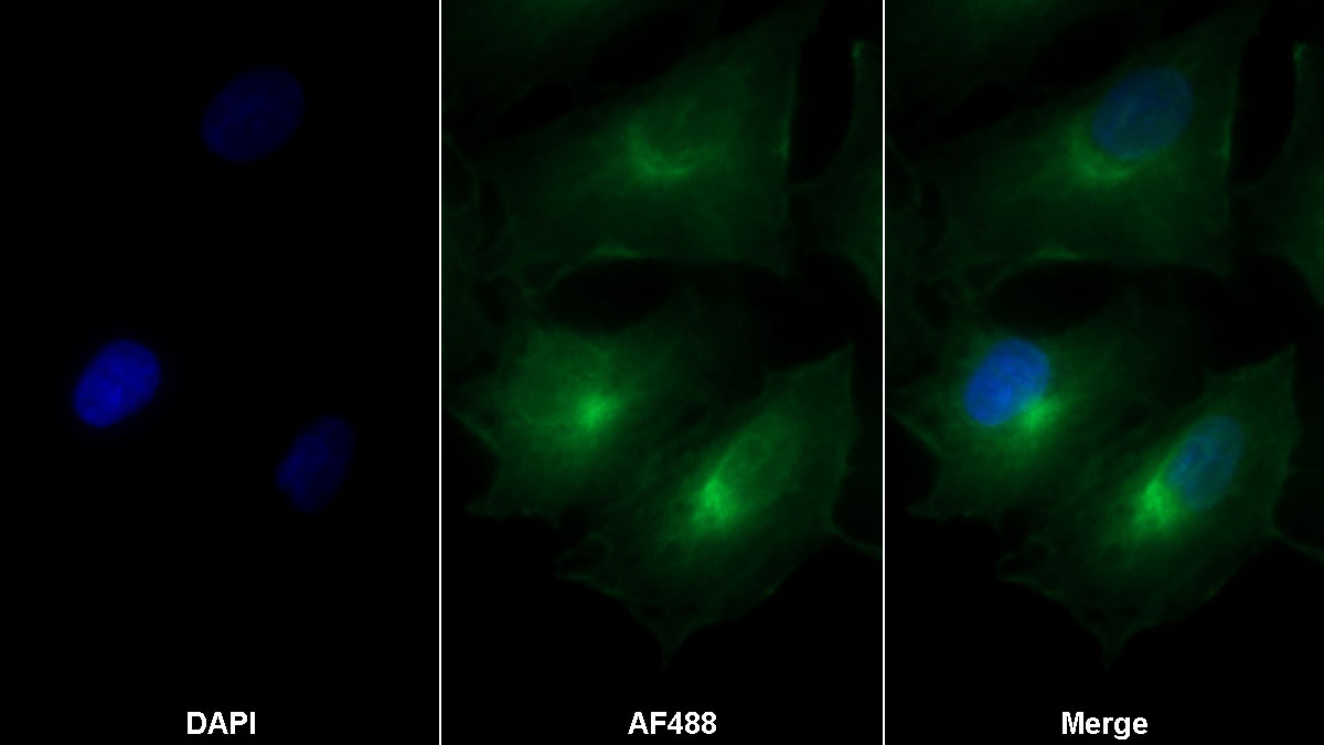 Monoclonal Antibody to Apoptotic Peptidase Activating Factor 1 (APAF1)