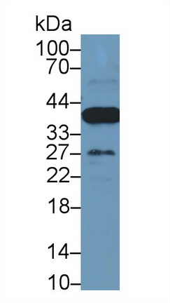 Monoclonal Antibody to Arginase (ARG)