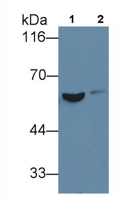 Monoclonal Antibody to Fibrinogen Beta Chain (FGB)