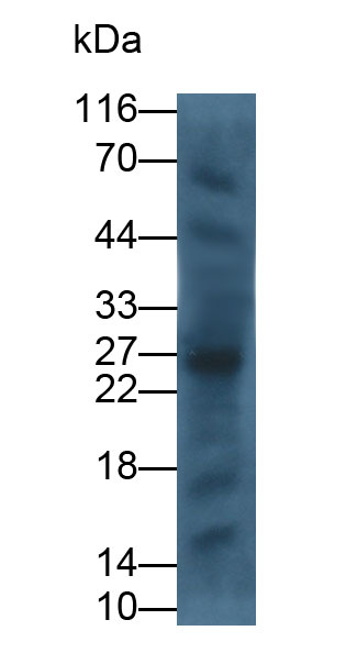 Monoclonal Antibody to Cytotoxic T-Lymphocyte Associated Antigen 4 (CTLA4)