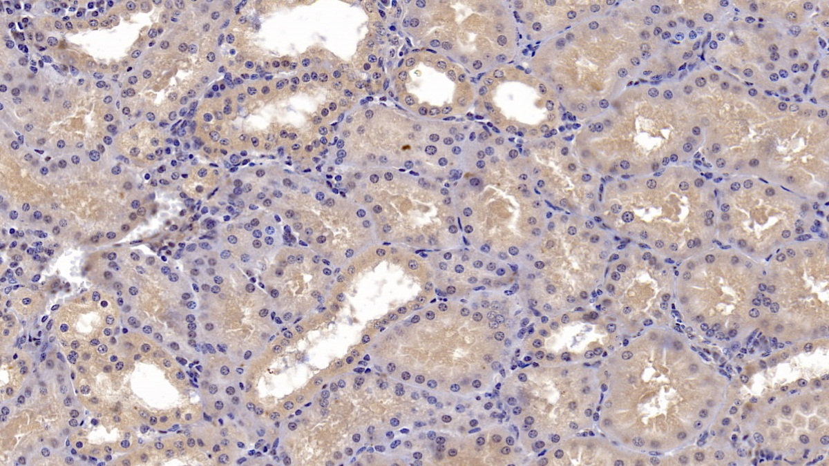 Monoclonal Antibody to Cluster Of Differentiation 73 (CD73)
