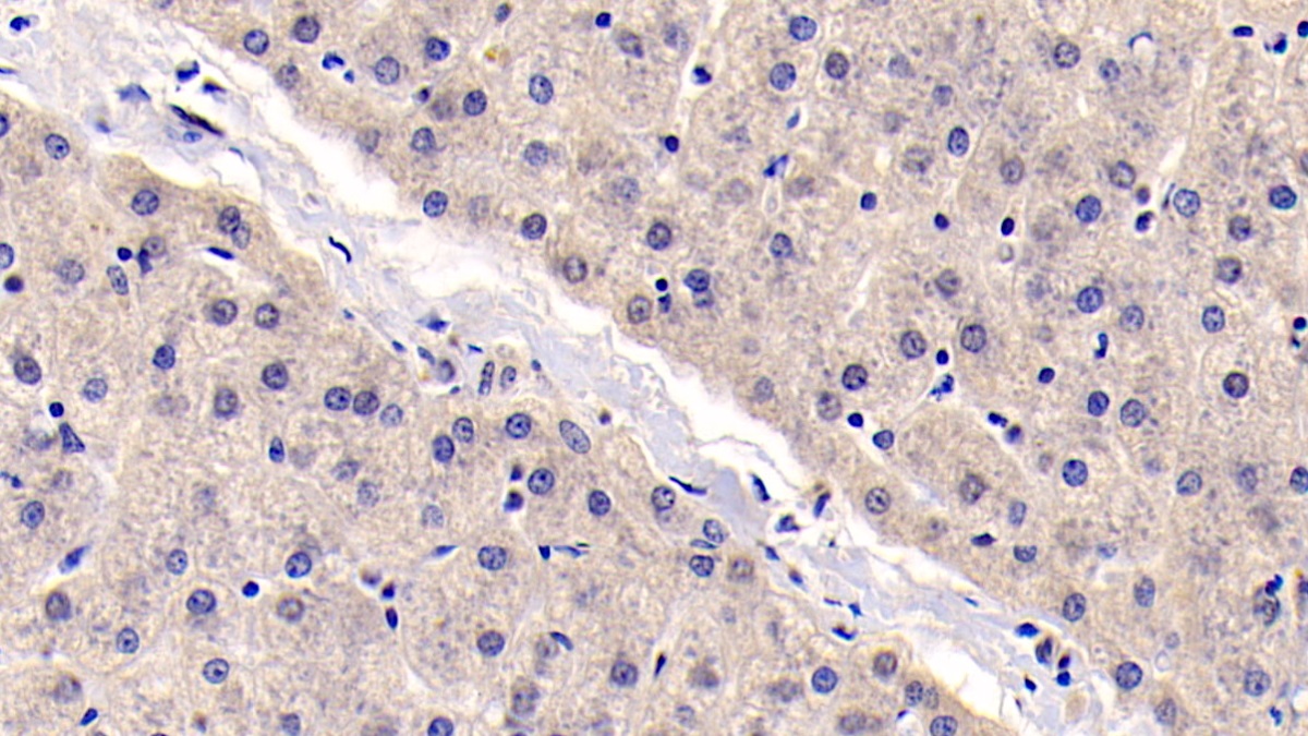 Monoclonal Antibody to Thymic Stromal Lymphopoietin (TSLP)