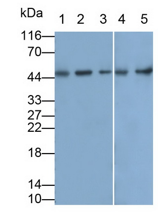 Monoclonal Antibody to Cluster of Differentiation 79B (CD79B)