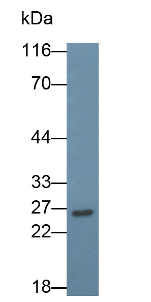 Monoclonal Antibody to Cluster of Differentiation 79B (CD79B)