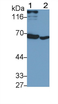 Monoclonal Antibody to Interferon Alpha/Beta Receptor 1 (IFNa/bR1)
