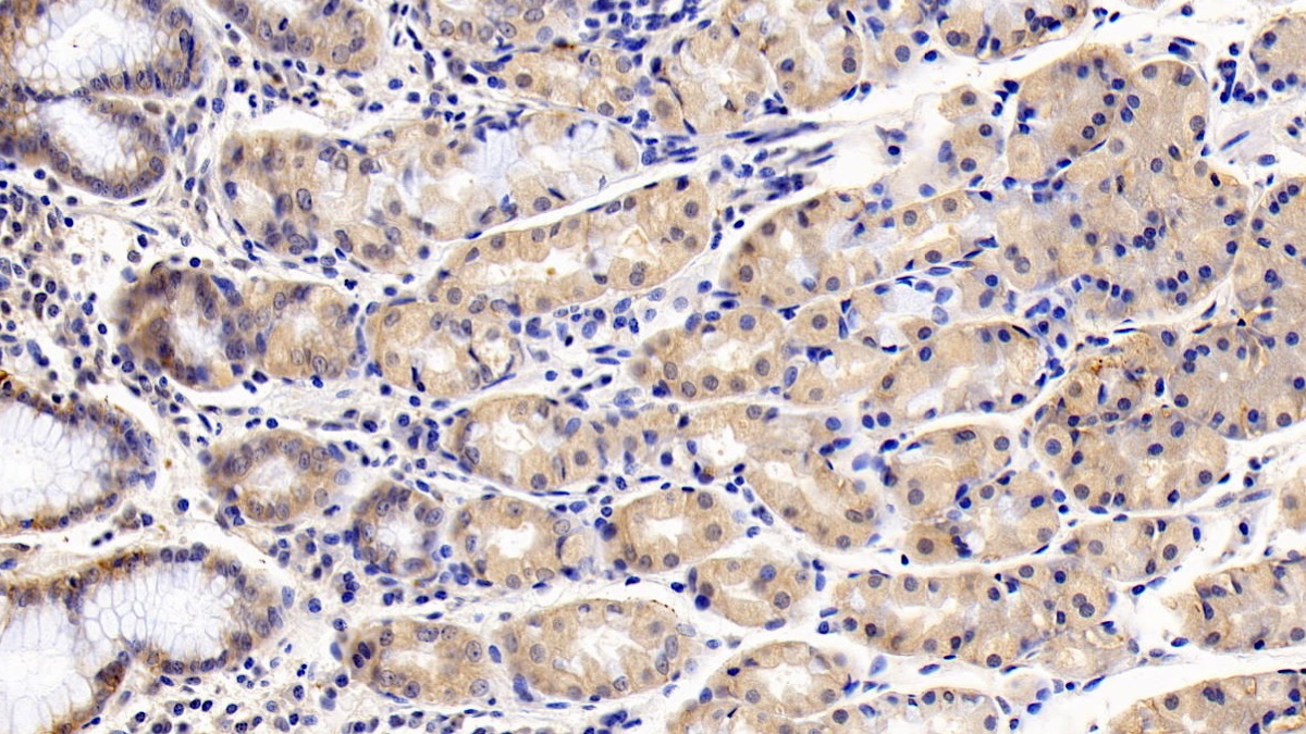 Monoclonal Antibody to Cluster Of Differentiation 147 (CD147)