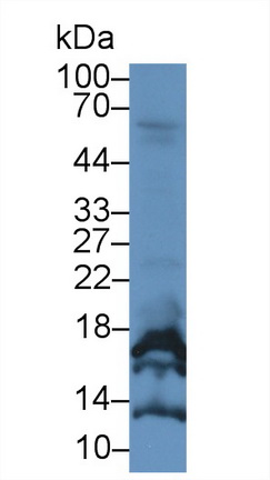 Monoclonal Antibody to Chorionic Gonadotropin Alpha Polypeptide (CGa)