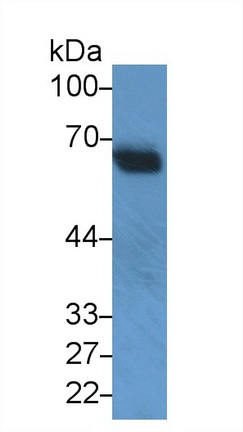 Monoclonal Antibody to Interleukin 10 Receptor Alpha (IL10Ra)