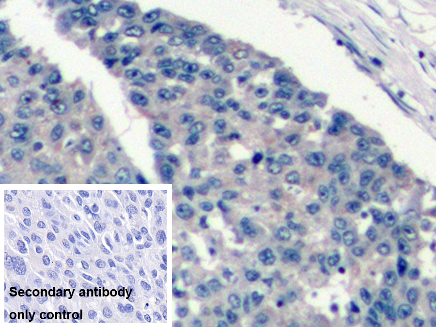 Monoclonal Antibody to Vascular Endothelial Growth Factor 165 (VEGF165)
