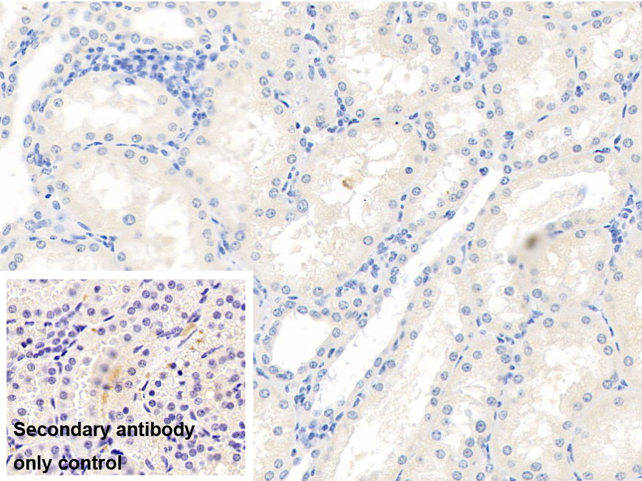 Monoclonal Antibody to Vascular Endothelial Growth Factor 165 (VEGF165)