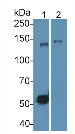 Monoclonal Antibody to Cluster Of Differentiation (CD163)