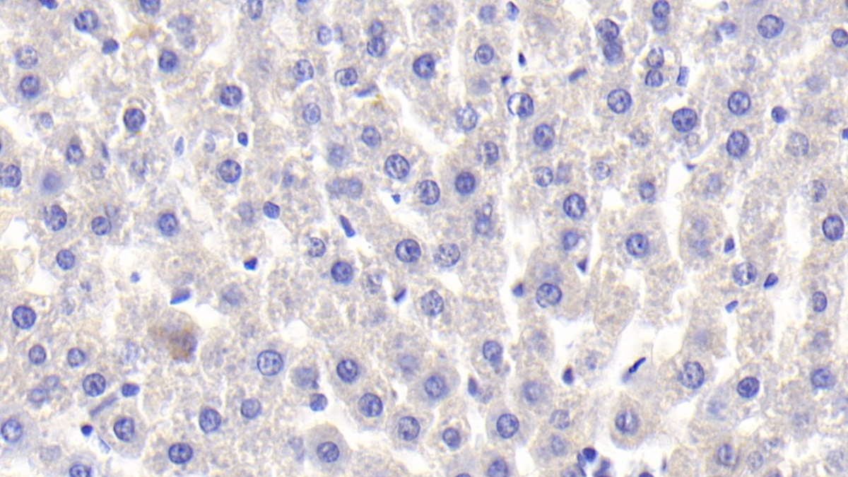 Monoclonal Antibody to Cluster Of Differentiation (CD163)