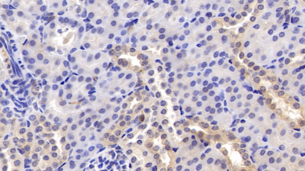 Monoclonal Antibody to Pigment Epithelium Derived Factor (PEDF)