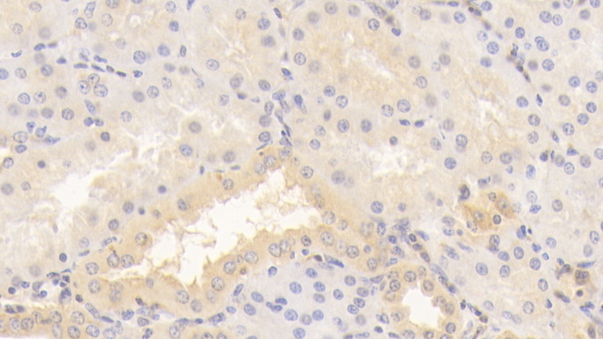 Monoclonal Antibody to Tenascin C (TNC)