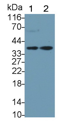 Monoclonal Antibody to Haptoglobin Related Protein (HPR)