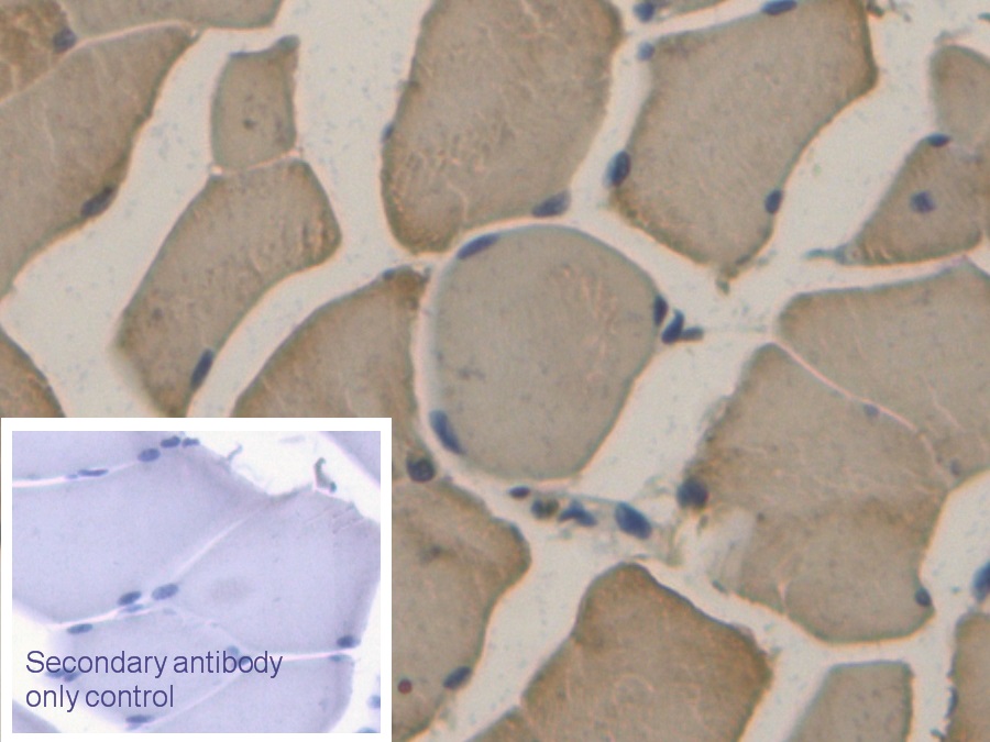 Monoclonal Antibody to Apolipoprotein B (APOB)