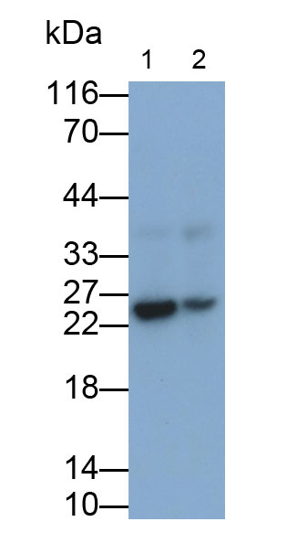 Monoclonal Antibody to Interleukin 35 (IL35)