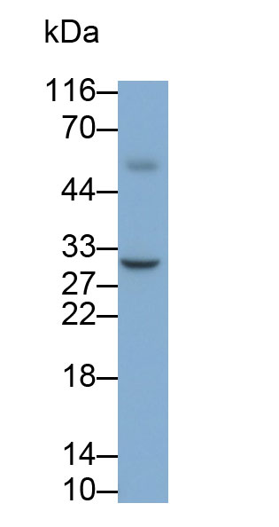 Monoclonal Antibody to Interleukin 35 (IL35)