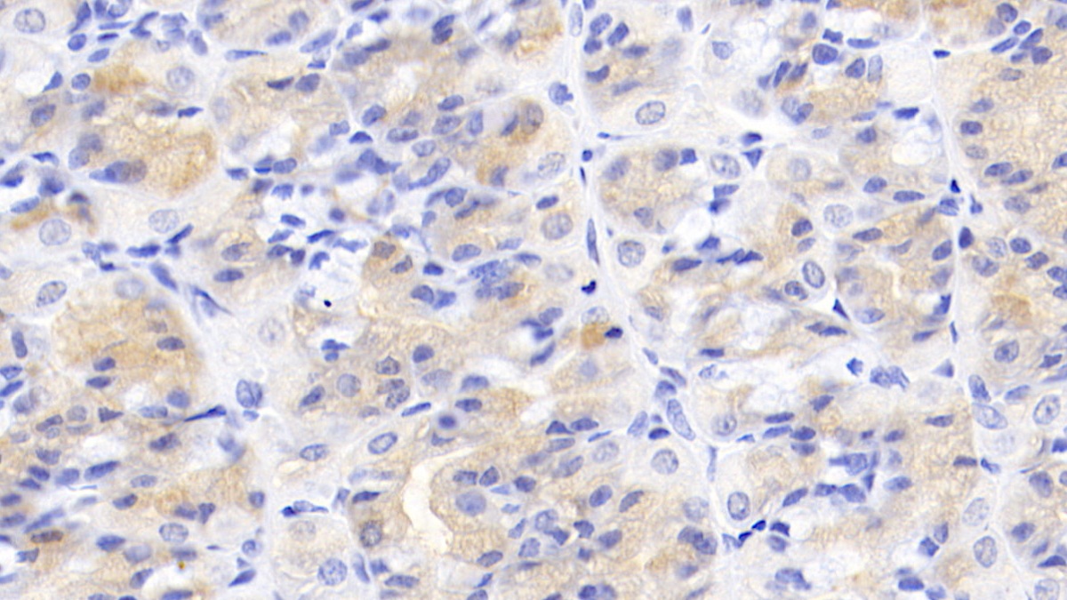 Monoclonal Antibody to Activin A Receptor Type II A (ACVR2A)