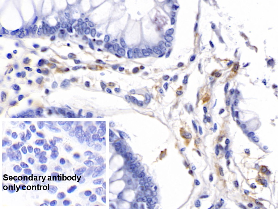 Monoclonal Antibody to HLA Class II Histocompatibility Antigen, DRB1 Beta Chain (HLA-DRB1)