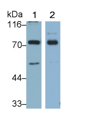 Monoclonal Antibody to Tumor Protein P63 (TP63)