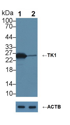Monoclonal Antibody to Thymidine Kinase 1, Soluble (TK1)