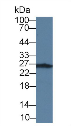 Monoclonal Antibody to Thymidine Kinase 1, Soluble (TK1)