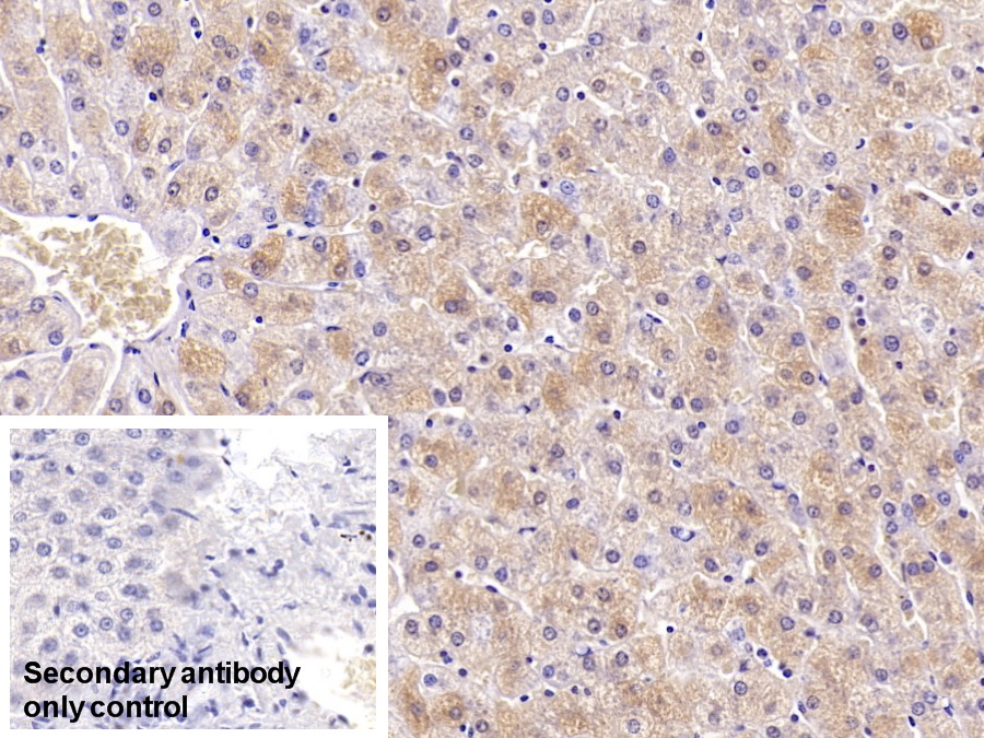 Monoclonal Antibody to Ferritin, Heavy Polypeptide (FTH)