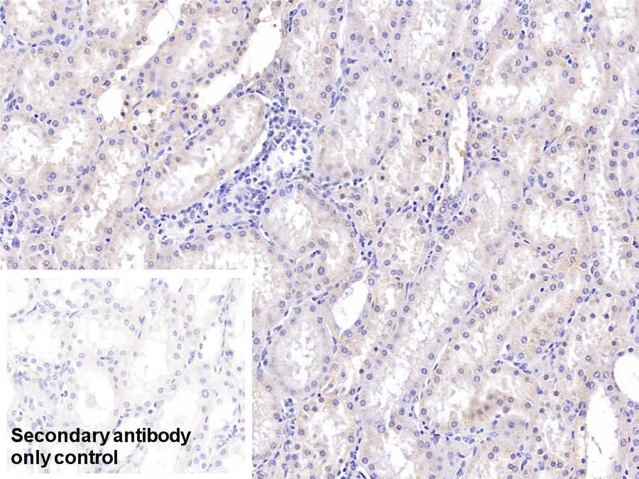 Monoclonal Antibody to Ribonuclease A2 (RNASE2)