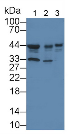 Monoclonal Antibody to Casein Kinase 1 Delta (CSNK1d)