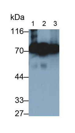 Monoclonal Antibody to Alpha-1-B-Glycoprotein (a1BG)