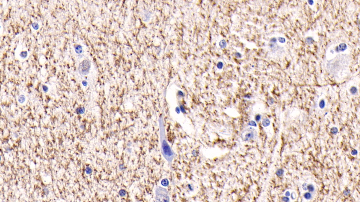 Monoclonal Antibody to Brain Specific Angiogenesis Inhibitor 3 (BAI3)